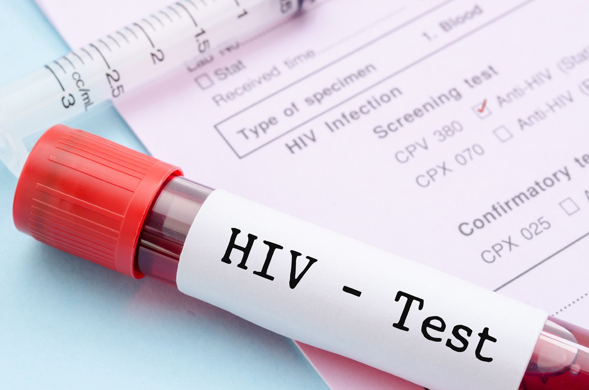 Federal Initiative Offers Free, HIV Self-Tests to Prevent Spread of the Virus