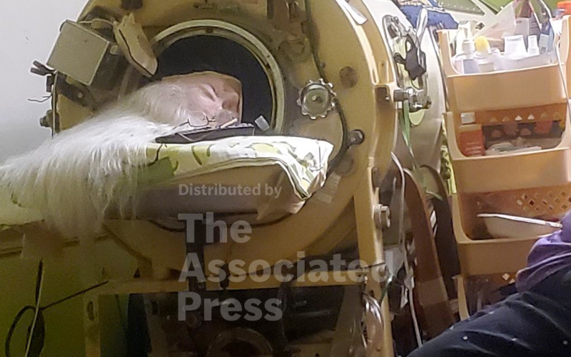 Martha Lillard, last US polio patient using iron lung, dies at 78 in Oklahoma